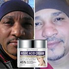 Kojic Acid Cream - 2 Fl Oz   60 Ml - Aha Skin Brightening Cream For Face  Body