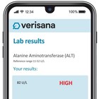 Comprehensive Liver   Kidney Test     Monitor 6 Important   Weiss