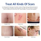  scar Removal Cream Gel For Surgical Scars  Acne Scars  Burns  And Stretch Marks
