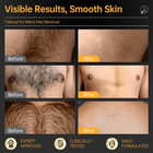 Ckm Hair Removal Cream For Men  Depilatory Cream For Unwanted Male Hair  Painles