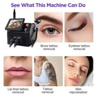 2 In1 Laser Soprano Hair Reomval Nd Yag Pico Laser Tattoo Hair Removal Machine