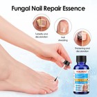 1 2 5pcs Fungal Treatment Fungal Effective Finger And Toe Nail Repair Solution