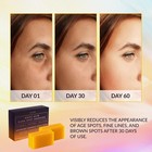 Valitic Kojic Acid Dark Spot Remover Soap Bars With Vitamin C  Retinol  Collagen