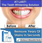 3pcs Whitening Teeth Bleach Gel Instant Whiter Advanced Bleaching White Stained