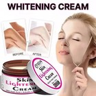 Kojic Acid Skin Whitening Lightening Brightening Bleaching spot Fade Cream 50g
