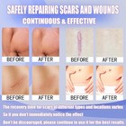Silicone Scar Sheets  3m-1 6  x120  roll    hypoallergenic Tape For Sensitive Skin