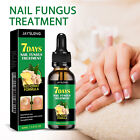 7 Days Nail Fungus Treatment All Natural Formula Gingers Nail Toenail Care 30ml