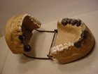 Vintage Medical Oddity Denture Mold Teeth Tooth Model Casting Cap Bridge Filling