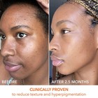 Dr Dennis Gross Alpha Beta Extra Strength Daily Peel 60 Treatments Exp 05 2028