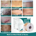 Silicone Scar Sheets  1 6 x 118  Roll-4m   Silicone Scar Tape For Scar Removal T