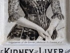 Sparks Kidney Liver Cure Advertising Sign  Camden New Jersey Bottle Bitters