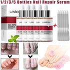 Lanbena Fungal Nail Repair Essence Serum Care Finger Toe Anti Nail Repair Liquid