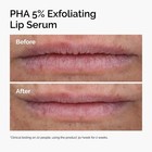 The Ordinary Pha 5  Exfoliating Lip Serum Hydrating Overnight Treatment 0 5oz