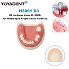 Us Dental Model Implant Practice Model For Dentistry Teaching Study Soft Gums