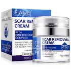 Scar Removal Cream - Rapid Repair Of New   Old Scars  Acne Spots  Burns