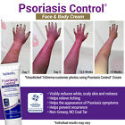 Triderma Psoriasis Control Face   Body Cream - Fsa Eligible  4 2 Oz - 4-pack