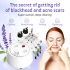 4 In1 Diamond Microdermabrasion Dermabrasion Facial Vacuum Spray Peeling Machine