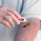 Wound-seal Hemostatic Powder     Portable First-aid For Rapid Bleeding Control
