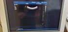 Philips Iu22 Diagnostic Ultrasound System Rev G 1