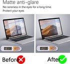 Apple Macbook Pro 15 Matte Anti Glare Screen Protector 3 Pack Lcd Protective