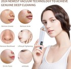 Blackhead Remover Pore Vacuumfacial Pore Cleaner-6 Suction Power3 Adjustable    