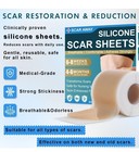 Silicone Scar Tape  Medical Grade Silicone Scar Sheets  1 6    X 60    Roll - 1 5m  