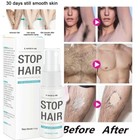 1-10pcs Permanent Hair Removal Cream Painless Stop Hair Growth Inhibitor Remover