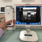 Digital Portable Ultrasound Equipment Linear   Convex Probe Ios Andriod