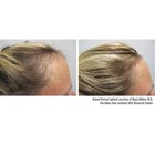 Viviscal Pro Advanced Hair Growth Supplement 180 Tablets Expiry 07 2027