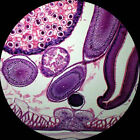 Amscope Ps50a 50 Biology Pathology Prepared Microscope Slides Set