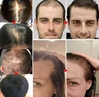 7 Days Fast Batana Oil Hair Growth Serum For Men   Women Anti-loss Hair