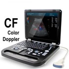 Color Doppler Ultrasound Scanner - Portable Laptop Digital Imaging System W 3d