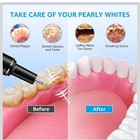 Teeth Cleaning Kit Plaque Remover For Teeth  Portable Dental Black 