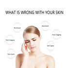 Pro Facial Microdermabrasion Dermabrasion Facial Peel Vacuum Skin Care Machine 