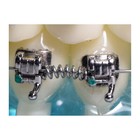 Dental Orthodontic 180mm Niti Open Coil Spring Arch Wires Alloy Dia 08 10 12 14