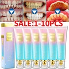 1-10pack Sp-6 Toothpaste  Sp-6 Tooth Paste  Sp-6 Probiotic Whitening Toothpaste