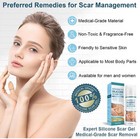 Advanced Silicone Scar Gel Treats Old And New Scars  Reduce The Appearance 50ml