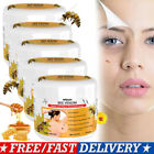  Bee Venom Skin Tag Removal Treatment Cream Body Care Mole Corn Wart Remover Us 