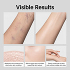 1-3 Pack Bruise Cream Extra Strength Skin Care   Bruise Relief Treatment