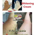 Whitening Body Cream Dark Spots  Skin Lightening Brightening New Smooth Lotion 6