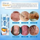 Wart Remover Cream Skin Tag Mole Remover Eliminate Foot Corn Warts