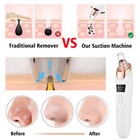 Blackhead Remover Pore Vacuum facial Pore Cleaner Tools-3 Suction Power 5 Probes