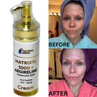 Dark Skin Whitening Dark Spot Brightening Bleaching Lightening Face Body Cream