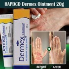 Dermatitis Cream  Eczema Cream  Fast-acting Itchy Skin Relief New Pack 20gm