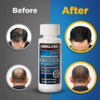 Kirkland Minoxidil 5  Extra Strength Men 6 Month Supply Hair Regrowth