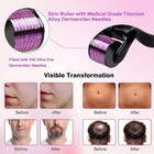 0 5mm Titanium Micro Needle Skin Roller 540 Needles For Derma Scars Cellulite