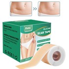 Silicone Scar Sheets   Tape Roll  1 6  x59      Scar Removal  Keloid  Acne marks