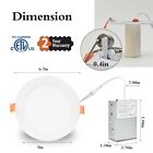 12 Pack 6 Inch 13w 5cct Ultra-thin Led Recessed Ceiling Light With Junction Box