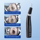 Dental Endo Ultra Activator Ultrasonic Root Canal Irrigator Handpiece 6 Tips