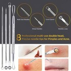 10 Pcs Pimple Popper Blackhead Remover Kit Tools Set Comedone Zit Extractor